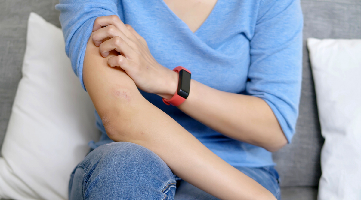 Top Tips for Spring Allergies