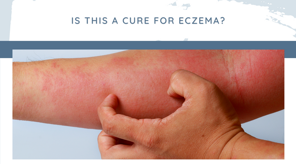 Is this a cure for eczema?