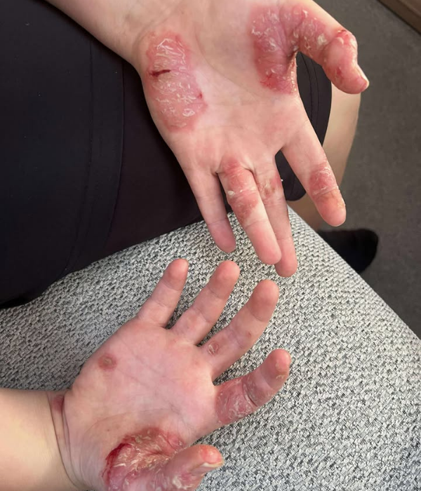 Before - Stacey C.